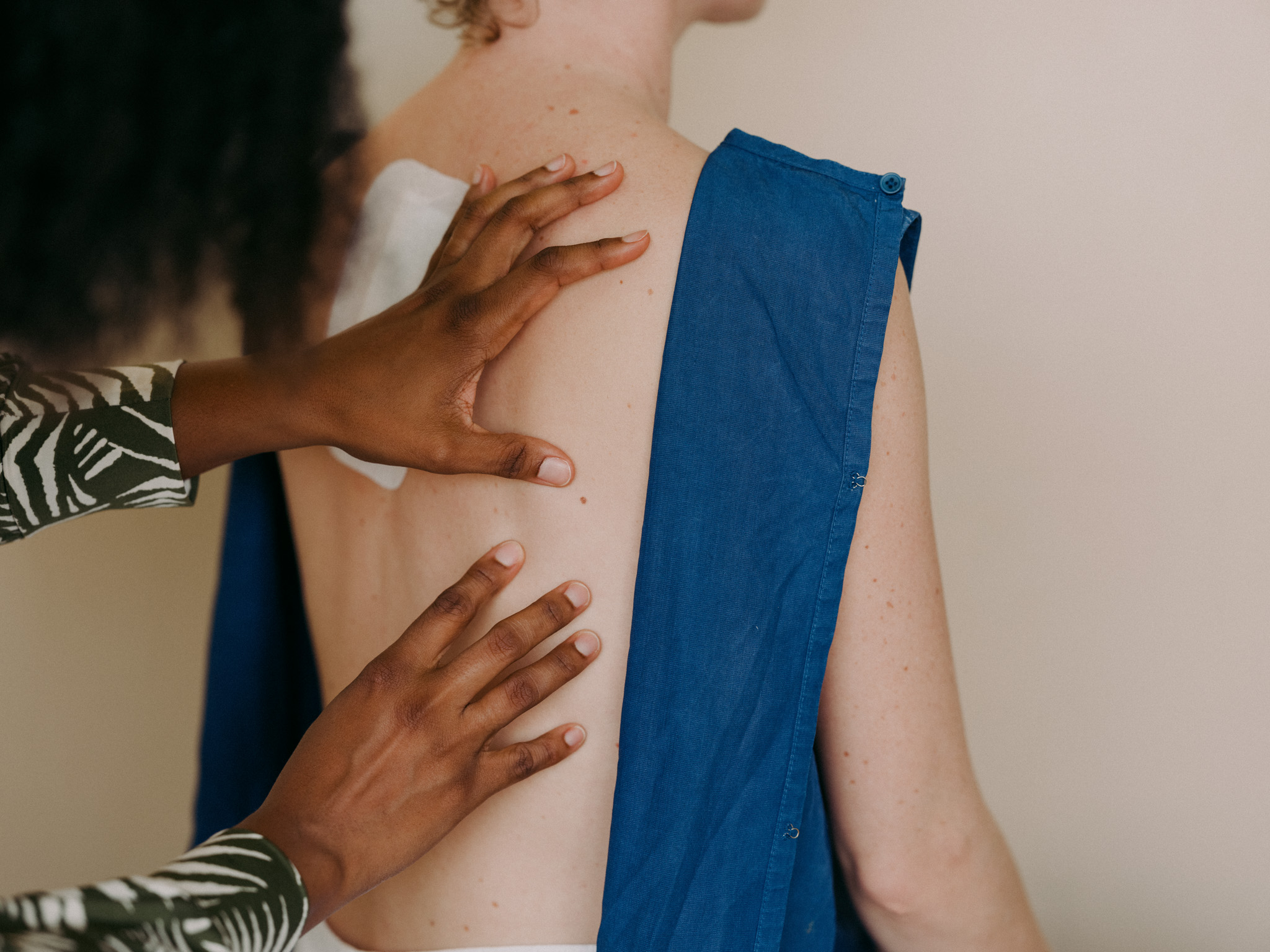 D&eacute;pistage du cancer de la peau, observation des grains de beaut&eacute; du dos