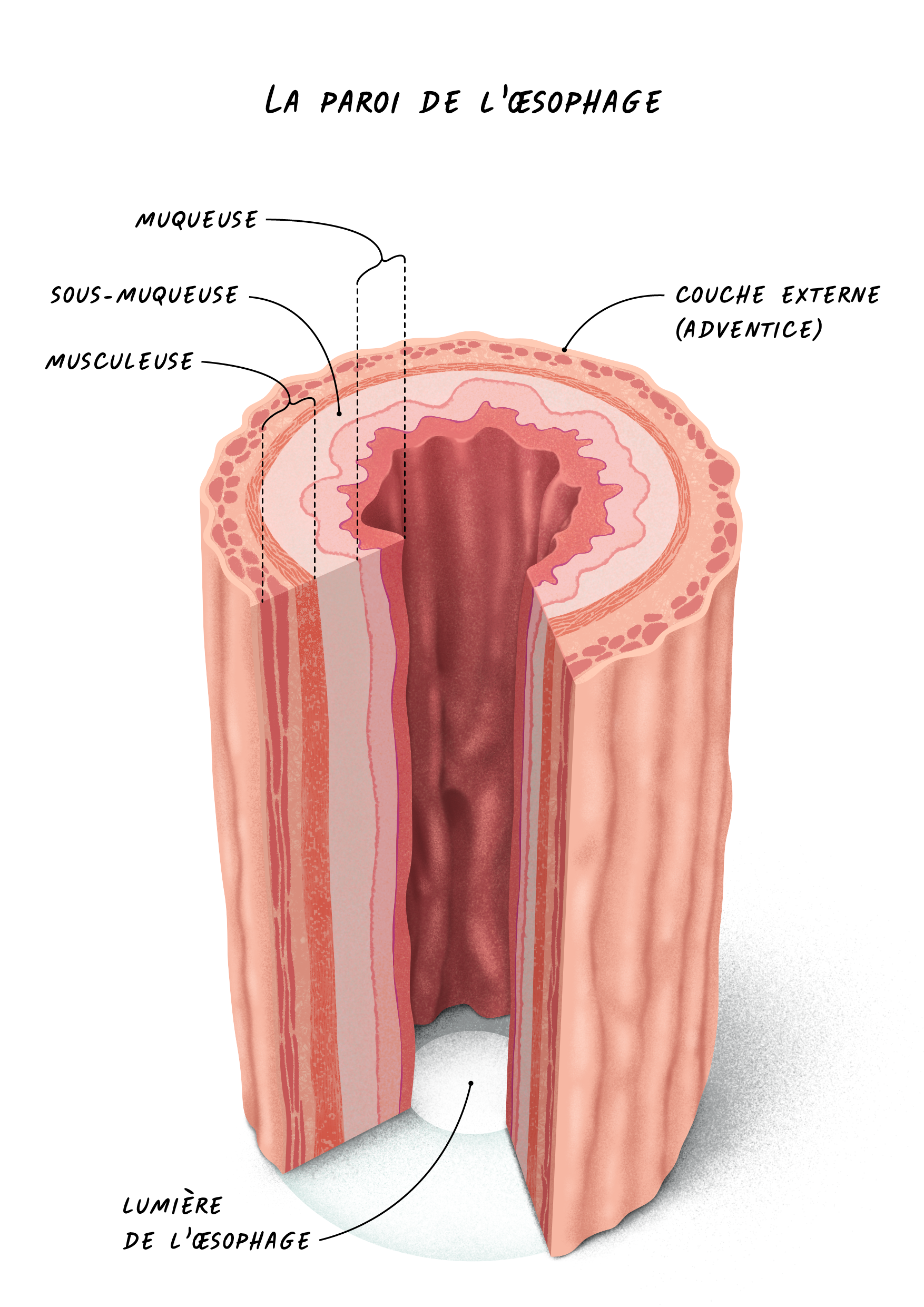 03c Cancers Œsophage - La Paroi De L'œsophage.png