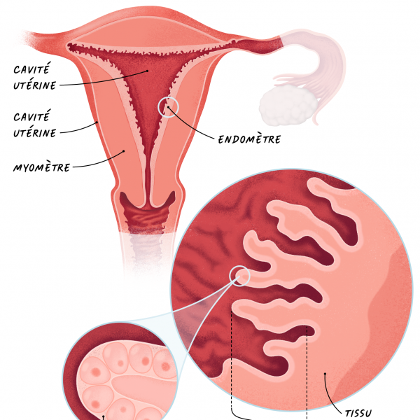 16c Cancers Endom&egrave;tre - Le Corps De L'ut&eacute;rus Et L'endom&egrave;tre.png